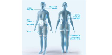 coolscuplting oakdale|CoolSculpting Elite .